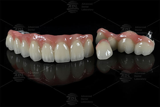Hypoallergenic PFZ dental solutions tailored to meet diverse clinical and dental lab needs services ensuring precision