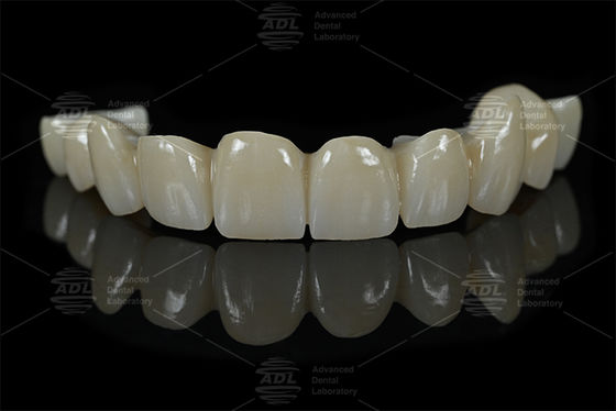 China Dental Lab Full Zirconia dental restorations dental lab specializing in AIDITE ZIRCONIA BLOCK materials for durable dental solutions