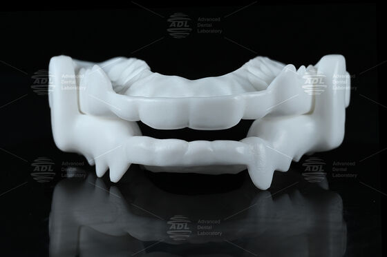 Medical-grade Nylon Occlusal Splint Night Guard with Flexible CAD/CAM Design for Bruxism Protection
